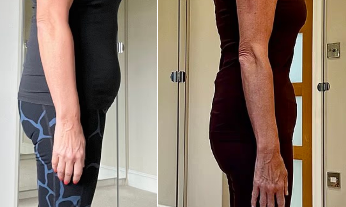 İngiltere'de yaşayan 56 yaşındaki Debbie Roper, menopoz sonrası 57 kilodan 70 kiloya çıktı. Fotoğraf: DailyMail
