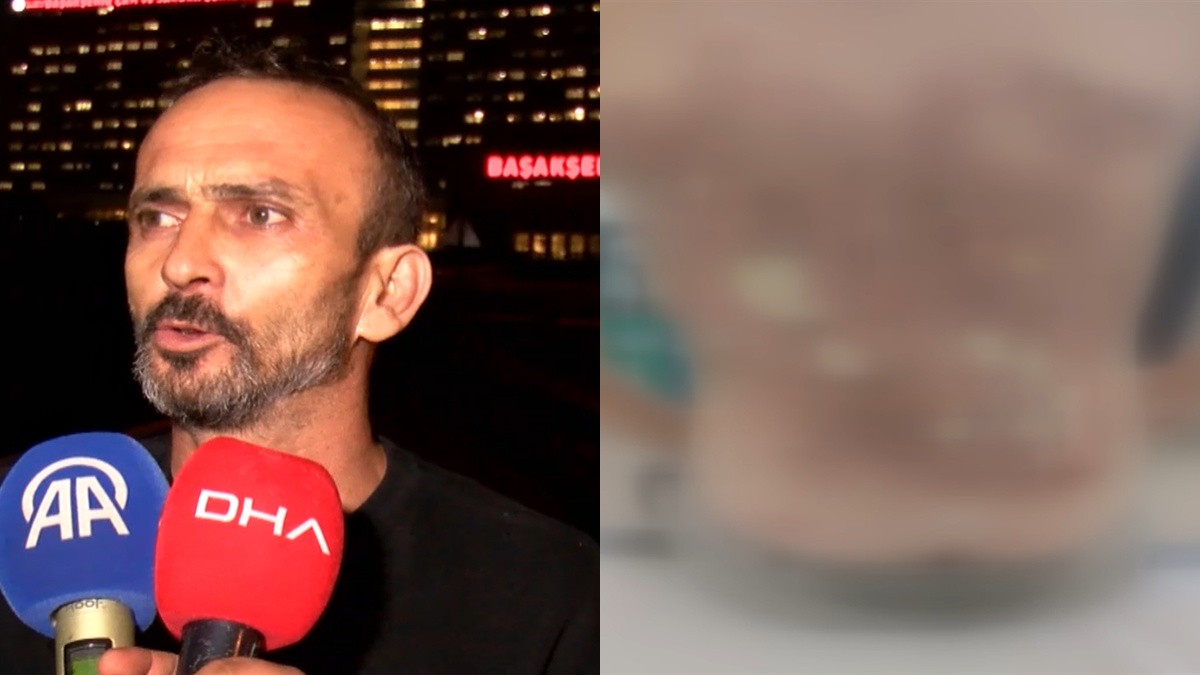 Baba Kadir Arslan, çocuğunun üçüncü derece yanıklar nedeniyle hastanede tedavi gördüğünü anlattı.