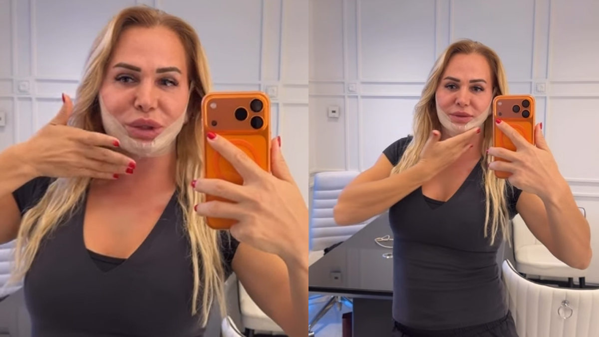 Nagihan Karadere'nin ameliyat sonrası yayımladığı videoda yüzündeki belirgin ödem ve şişlikler göze çarptı.