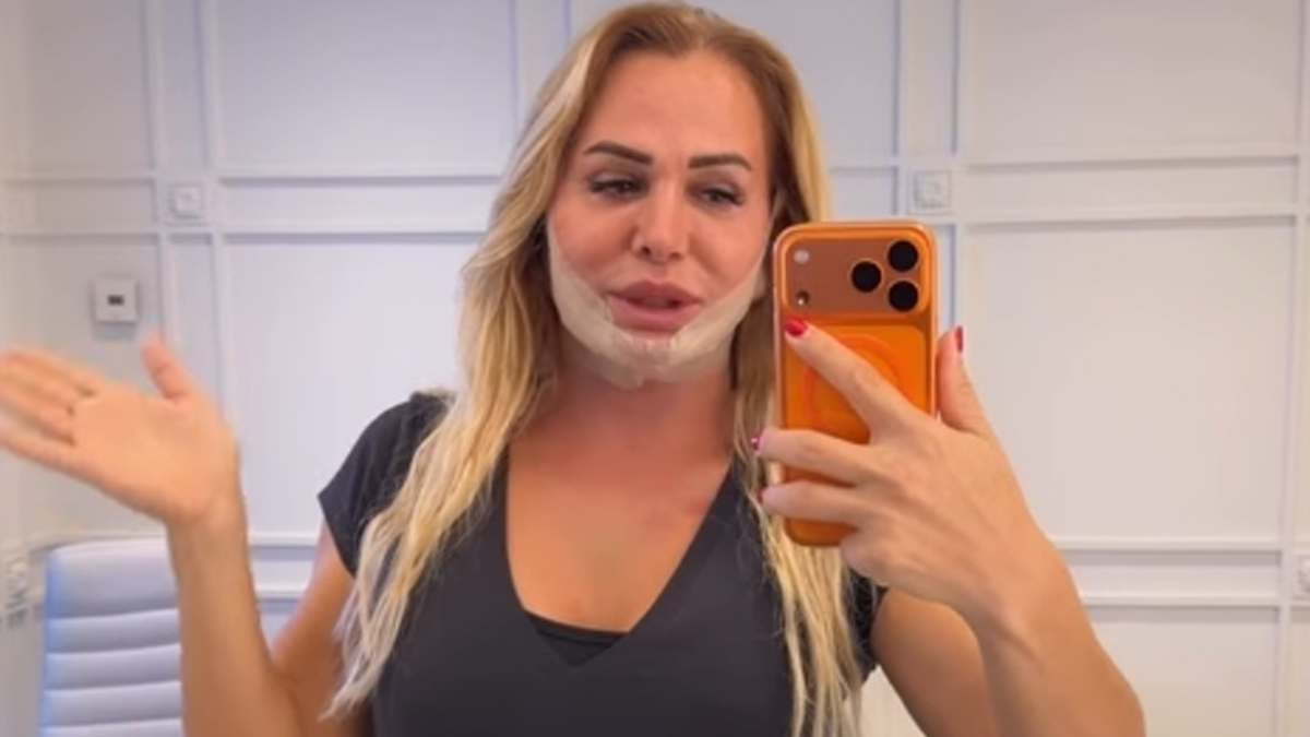 Geçirdiği estetik operasyon öncesinde ʺBarbie gibi olacağımʺ diyen Karadere'nin son hali sosyal medyada paylaşıldı.
