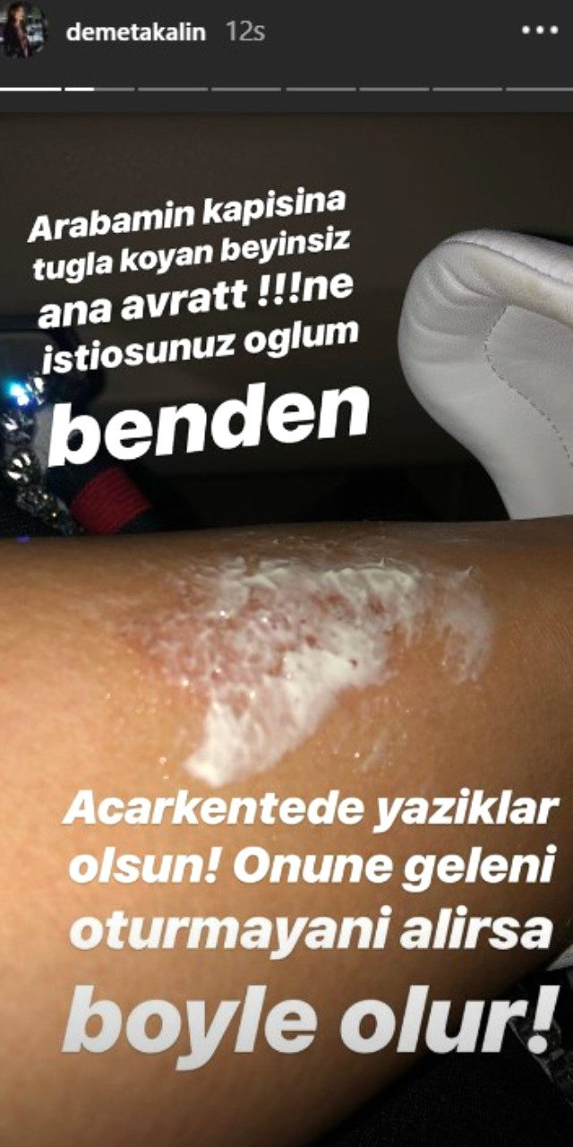 Demet Akalın çılgına döndü! Demet Akalın yaşadığı olay karşısında ana avrat...