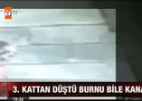 3. Kattan düştü burnu bile kanamadı