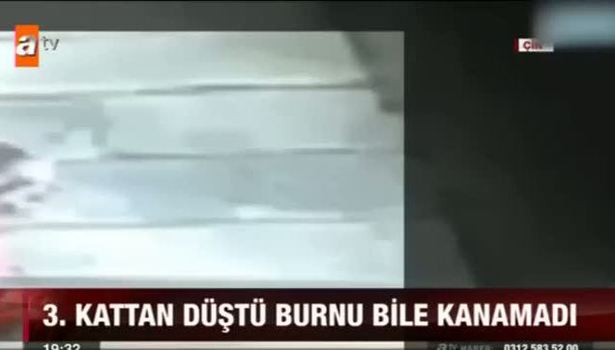 3. Kattan düştü burnu bile kanamadı