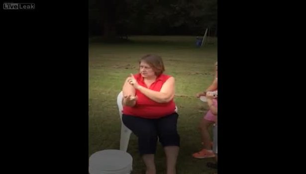 Pitbull yüzünü böyle parçaladı
