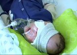 Beyni gözüne inen bebek yardım bekliyor
