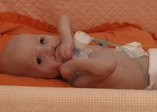 Aslan sendromlu bebek yardım bekliyor