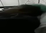 Narkozun etkisiyle lorke şarkısını söyledi