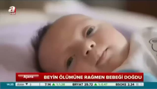 Polonya’da mucizevi doğum